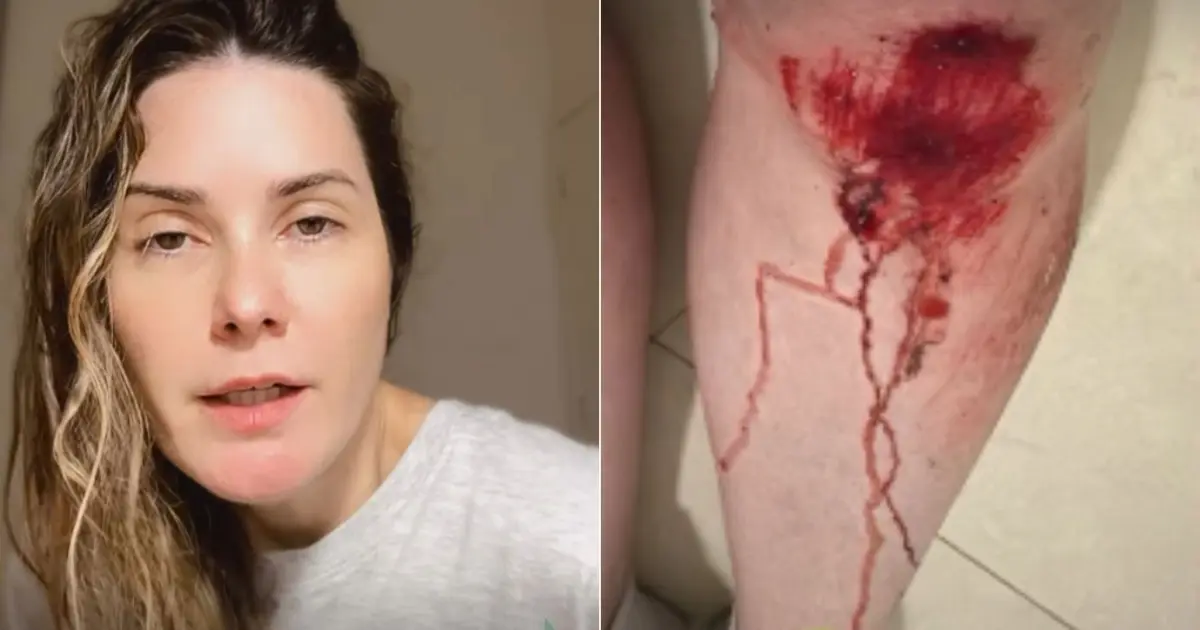 Imagem de Repórter da RecordTV Bahia tem celular roubado em Ondina e recupera aparelho com ajuda de vizinhos e motoboy