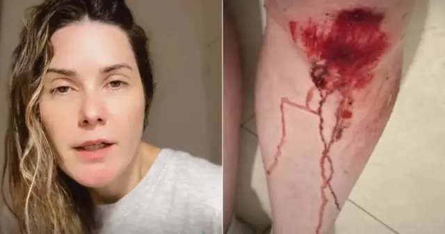 Imagem de Repórter da RecordTV Bahia tem celular roubado em Ondina e recupera aparelho com ajuda de vizinhos e motoboy